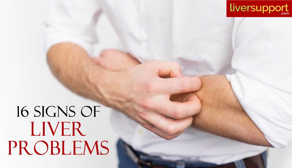 16 signs of liver problems