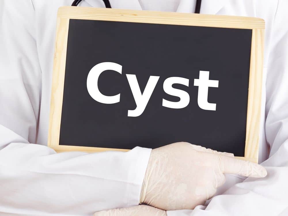 Liver Cysts: Symptoms, Causes and Treatment
