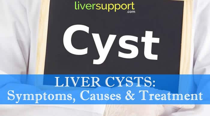 Liver Cyst - its symptoms, prevention and treatment - MyHealth