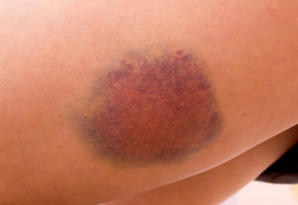 7 Symptoms of Liver Disease You Should Know About