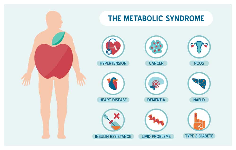 Metabolic syndrome is the connection between psoriasis and NAFLD.