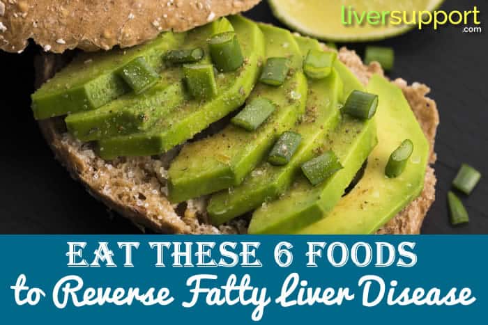 6 Foods To Reverse Fatty Liver Fatty Liver Diet LiverSupport