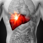 Liver pain caused by acute liver failure