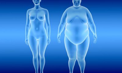 Weight and Obesity May No Longer Be Leading Indicators of Fatty Liver Disease