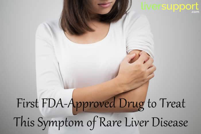 First FDA-Approved Drug to Treat This Symptom of Rare Liver Disease