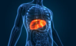 Can Kisspeptin Help Treat NAFLD?