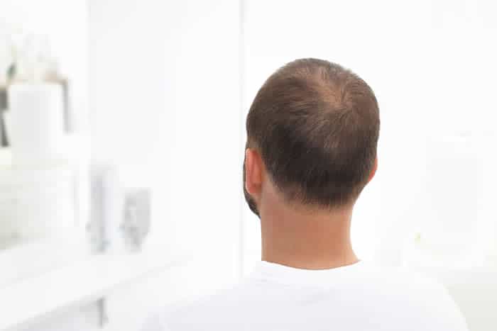 Fatty Liver Disease Symptoms to Watch for from Head to Toe