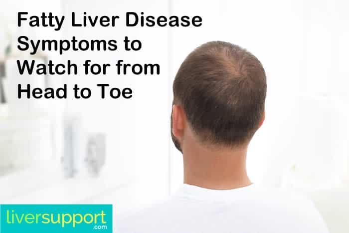 Fatty Liver Disease Symptoms to Watch for from Head to Toe