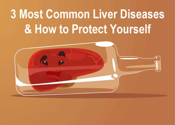 3 Most Common Liver Diseases & How to Protect Yourself