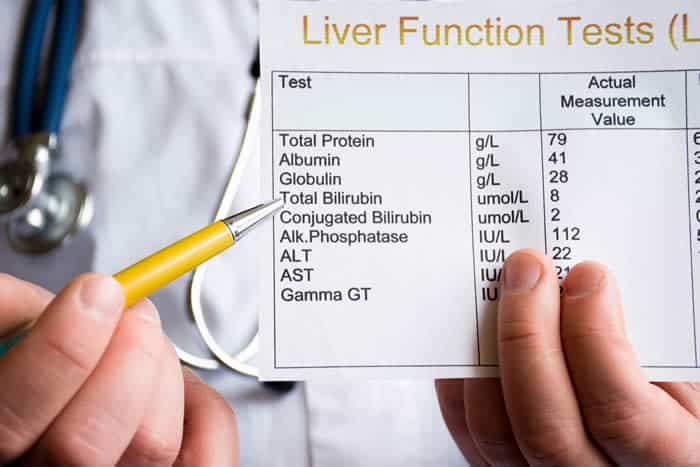 There are at-home tests you can use to check the health of your liver.