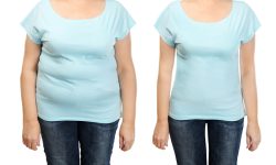 Pros and Cons of Weight Loss Surgery for Liver Health
